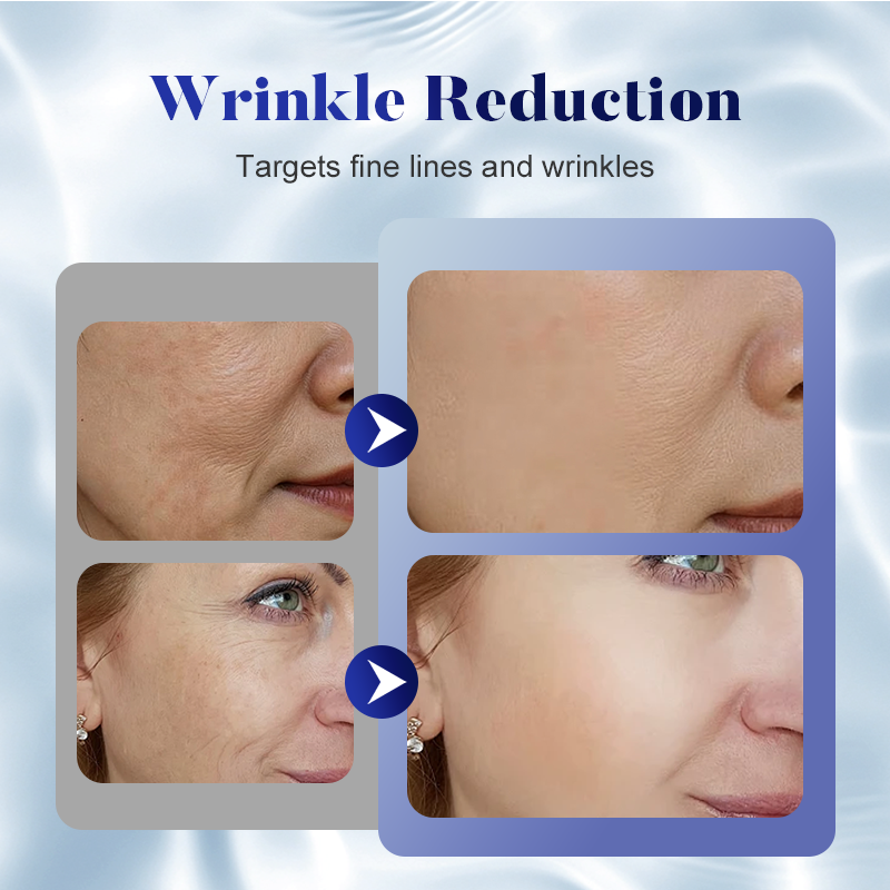⏳Limited-time 50% off⏰Anti-Wrinkle Firming Face Cream – Advanced Peptide Formula to Smooth Wrinkles, Firm Skin & Restore Youthful Glow! 🧬✨