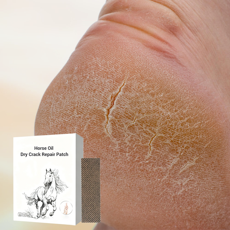 ⏳Limited-time 50% off⏰Horse Oil Dry Crack Repair Patch for Hands & Feet🩹