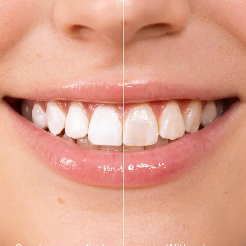 ⏳Limited-time 50% off⏰Instant Whitening Tooth Paint😁🦷